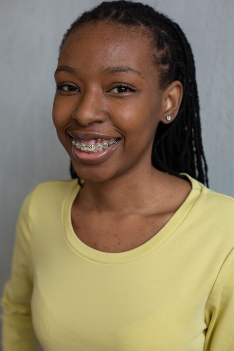 Ceramic braces